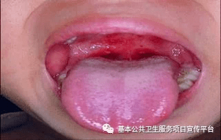 哔哩哔哩封号怎么办？解决办法与预防指南